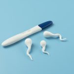 É possível reverter uma vasectomia feita há 10, 15 ou mais anos?